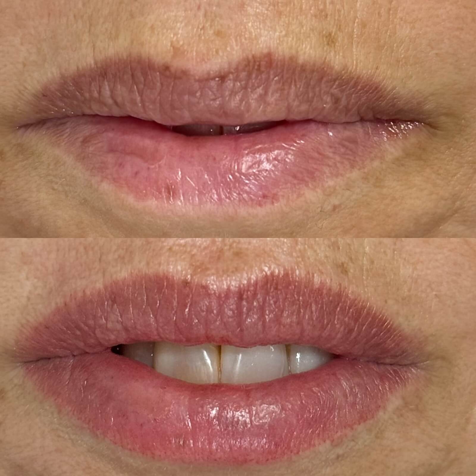 MicroPigmentação labial antes e depois