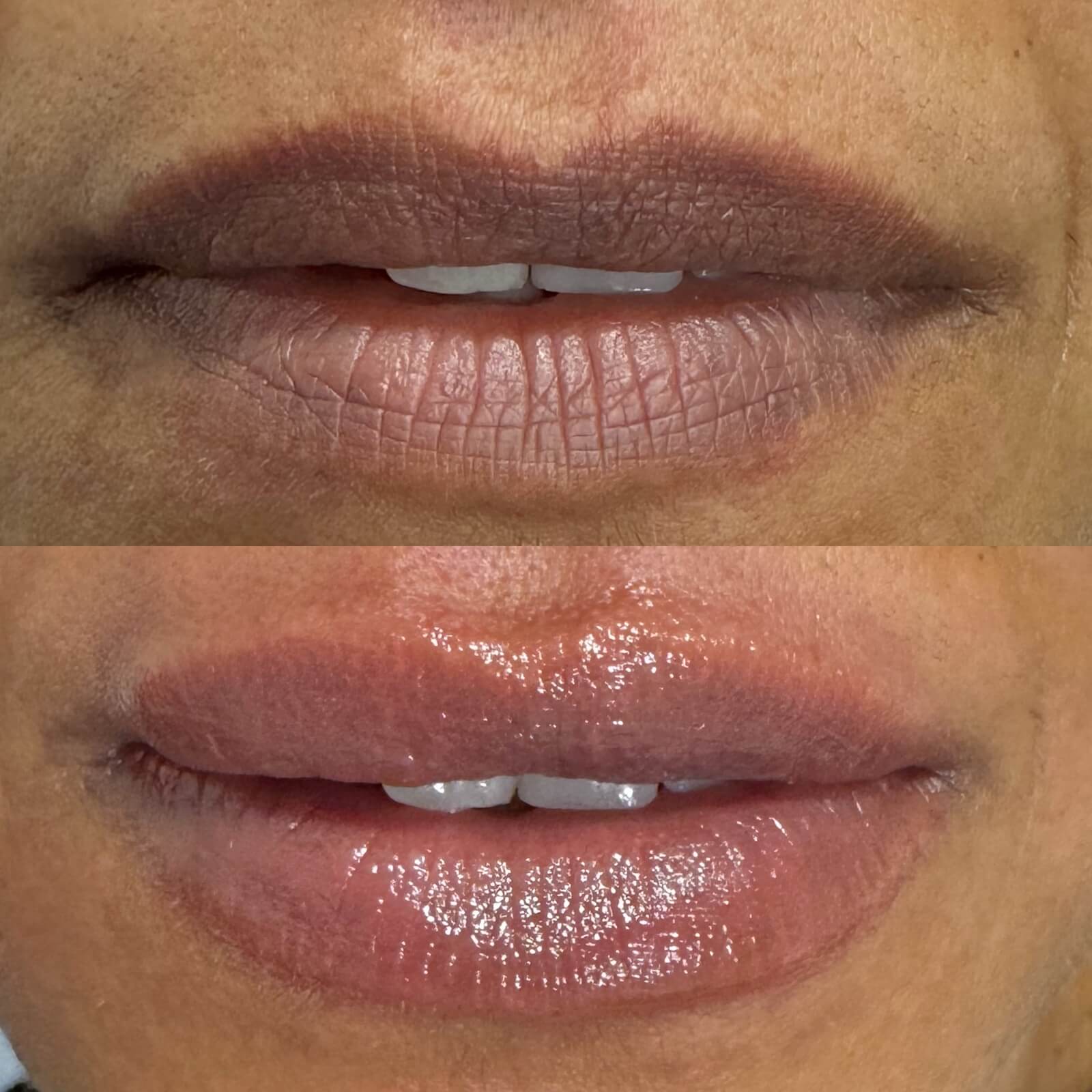 MicroPigmentação labial antes e depois