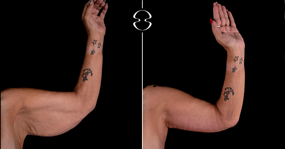 Vanda Martinho Antes e Depois Casa Feliz