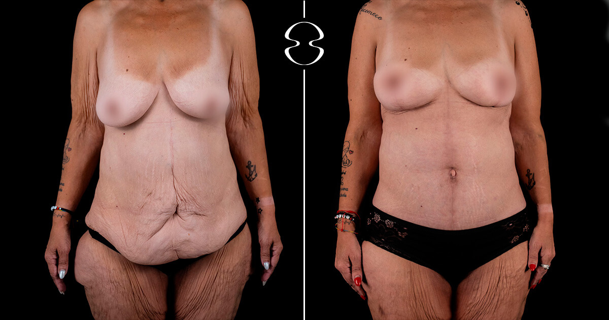 Vanda Martinho Antes e Depois Casa Feliz