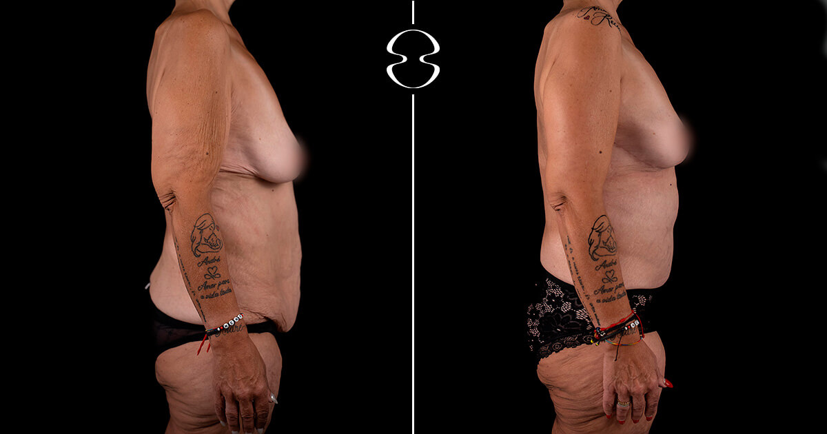 Vanda Martinho Antes e Depois Casa Feliz