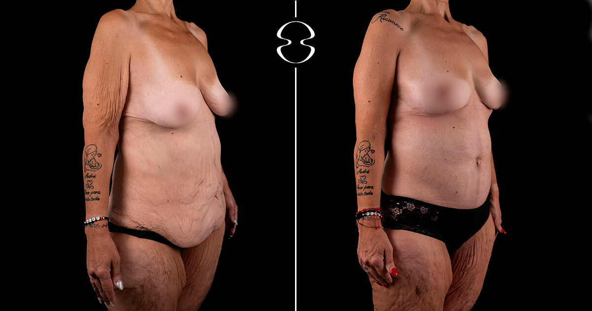 Vanda Martinho Antes e Depois Casa Feliz