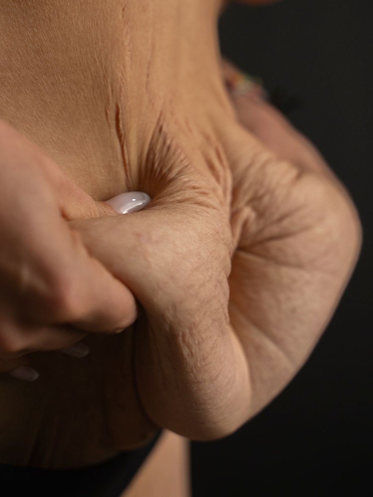 Liliana Carromeu antes MyMoment