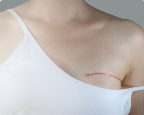 Crisalix 3d em mamoplastia | Mymoment Lisboa