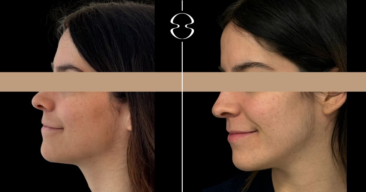 caso dermatologia antes e depois