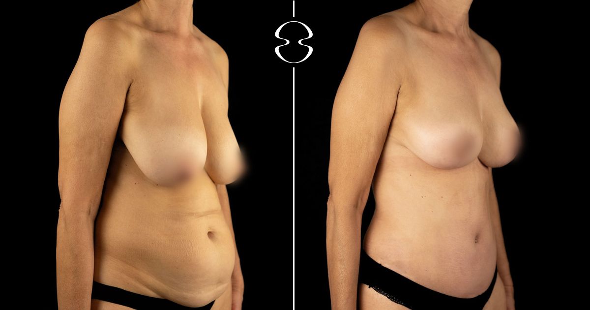 maria goreti santos antes e depois