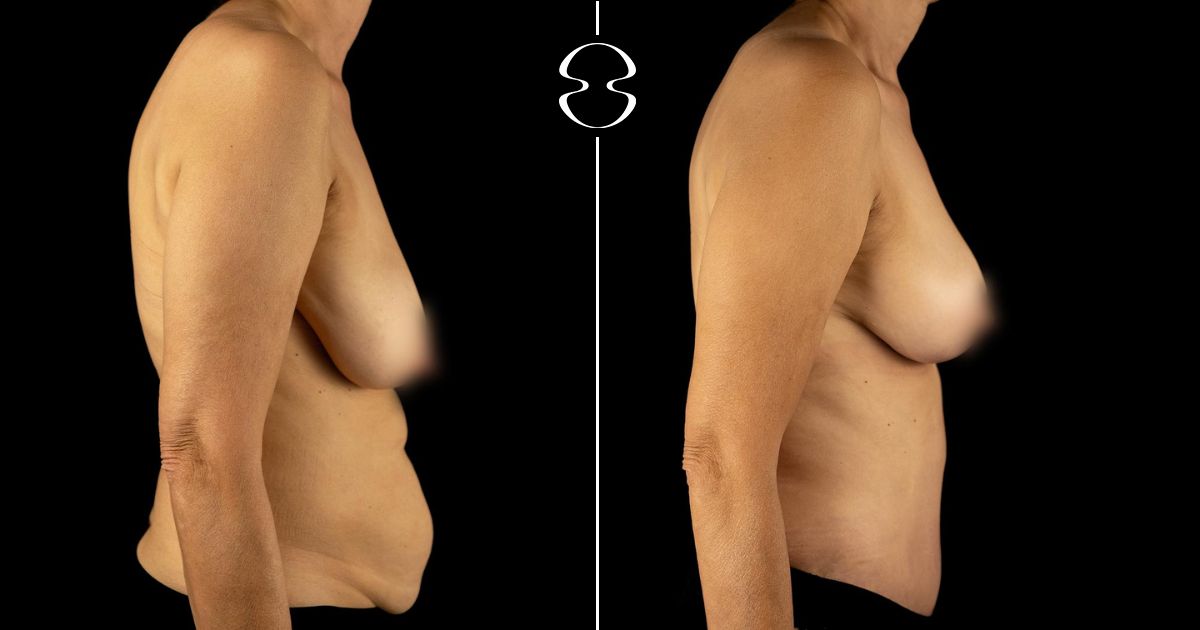 maria goreti santos antes e depois